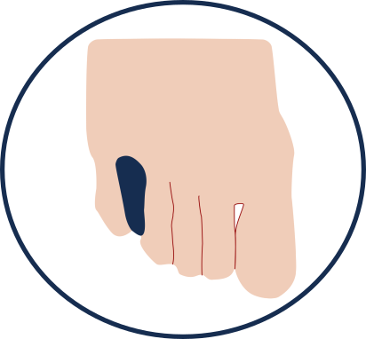 Orthoplasties